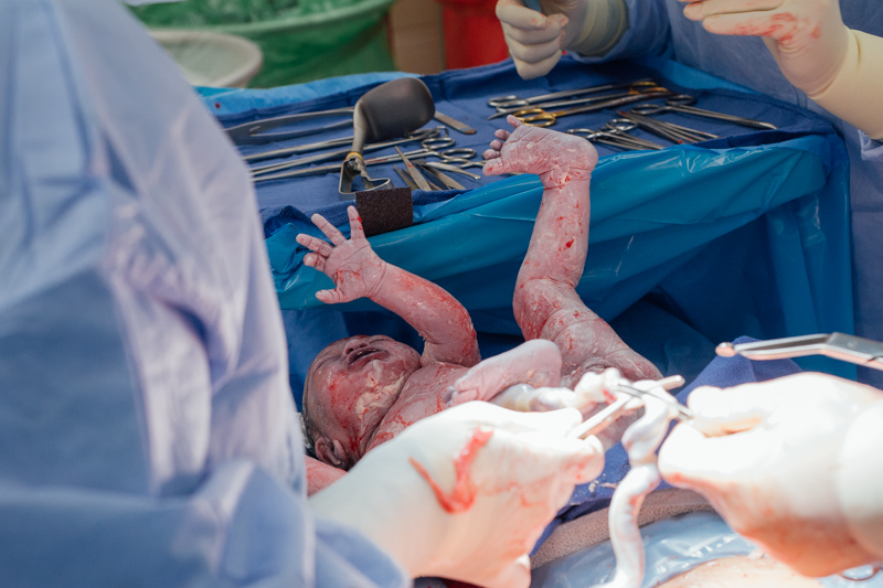 imok-youreok-pregnancy-delivery_0029